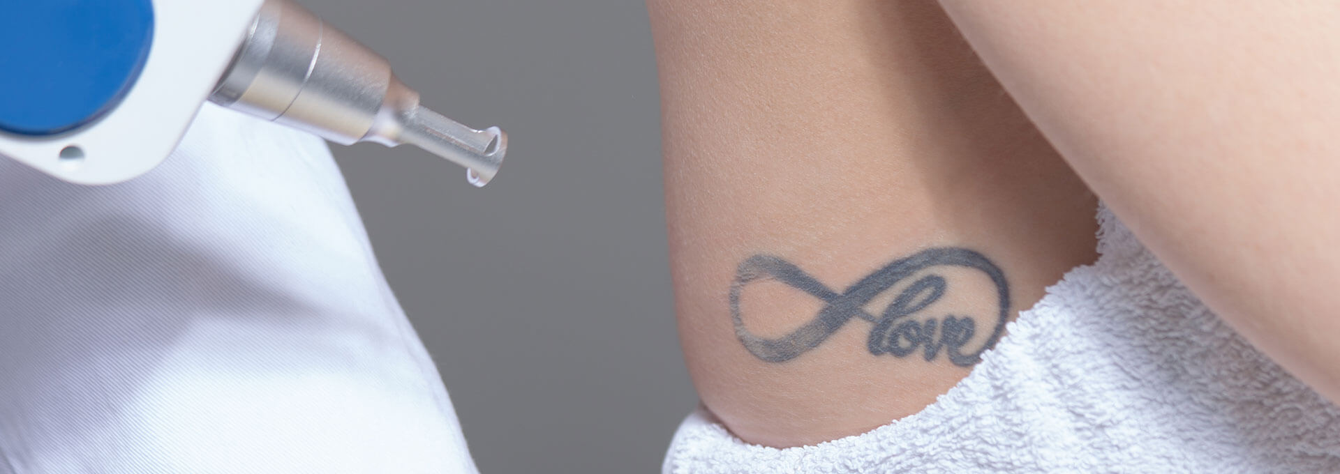 Tattoo Removal Service